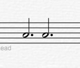 Overture 5设置延音线的方法