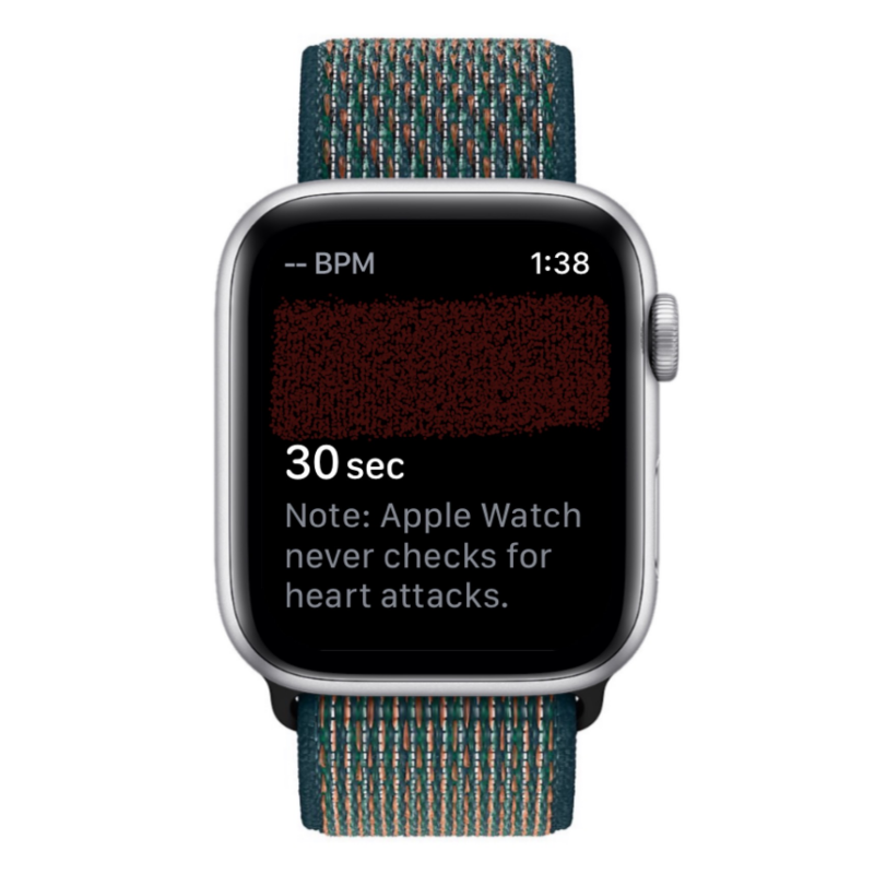 Apple Watch 心电图记录:详细步骤指南