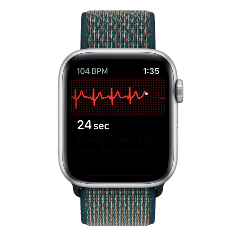 Apple Watch 心电图记录:详细步骤指南