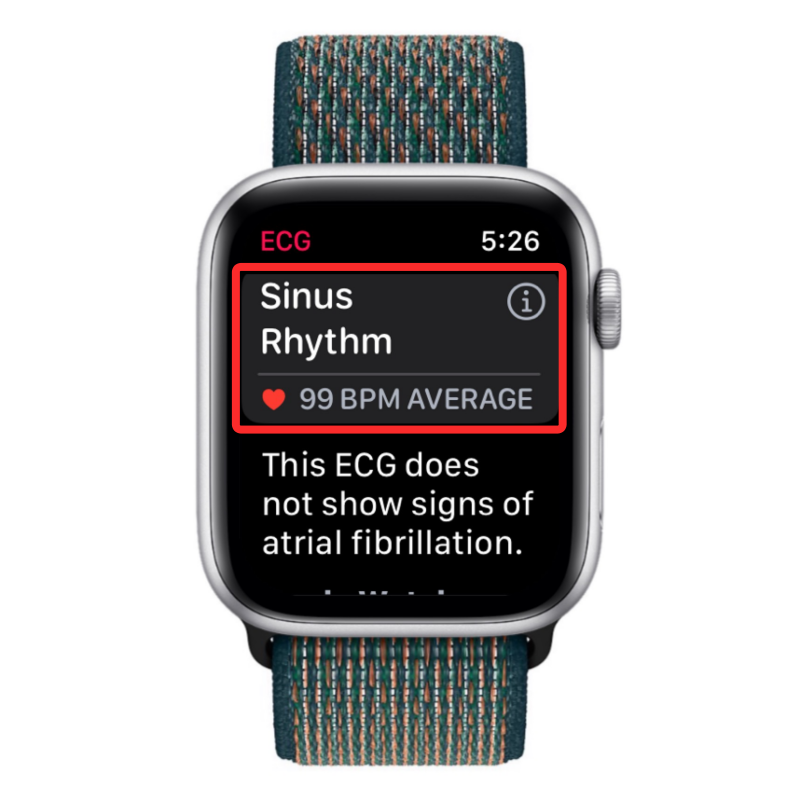 Apple Watch 心电图记录:详细步骤指南