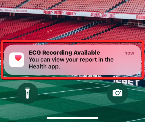 Apple Watch 心电图记录:详细步骤指南