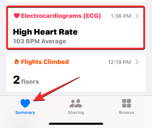 Apple Watch 心电图记录:详细步骤指南