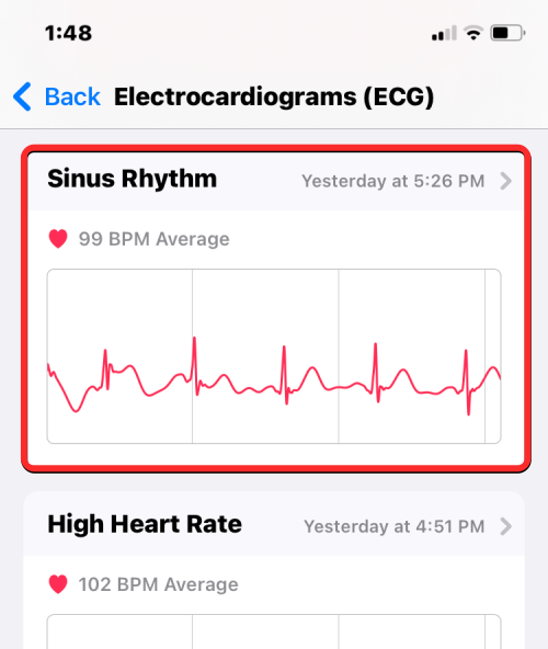 Apple Watch 心电图记录:详细步骤指南