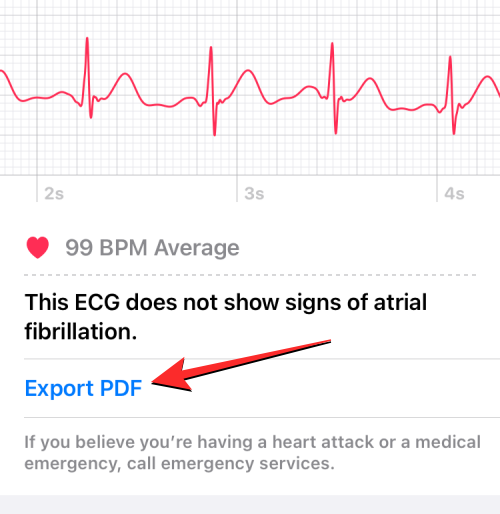 Apple Watch 心电图记录:详细步骤指南