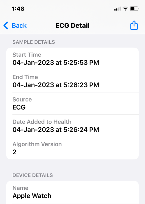 Apple Watch 心电图记录:详细步骤指南