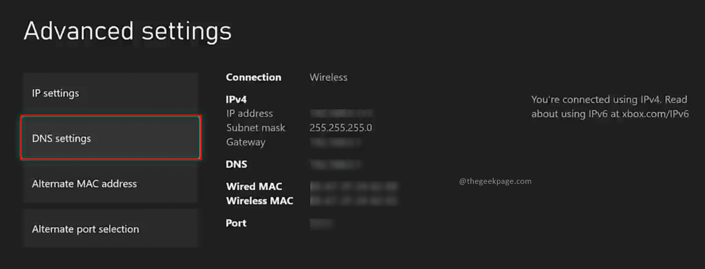 优化 Xbox Series S/X 的下载速度、降低 ping 和延迟的方法