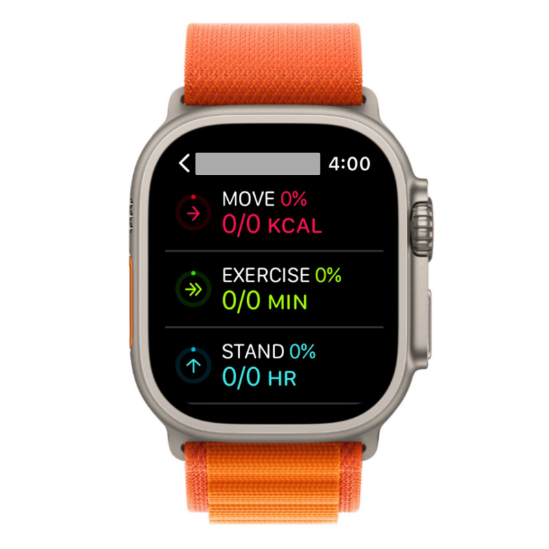 在 Apple Watch 上分享健身:逐步指南
