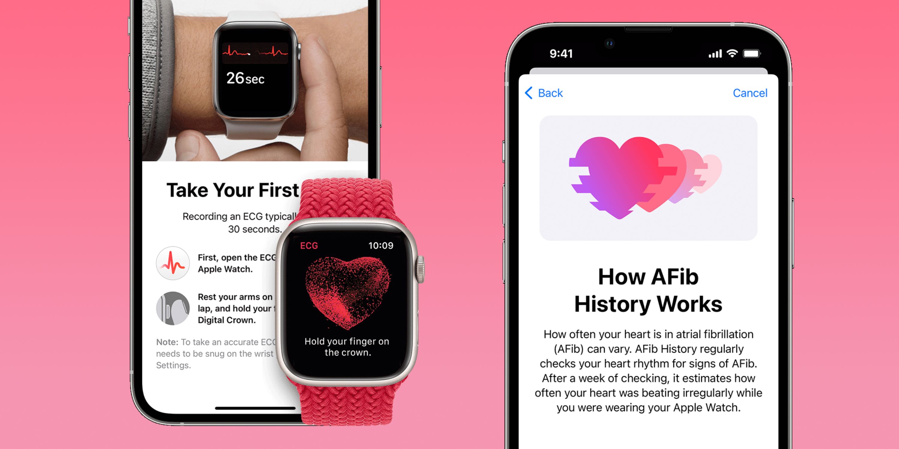使用 Apple Watch 检查和改善心脏健康的 7 种重要方法