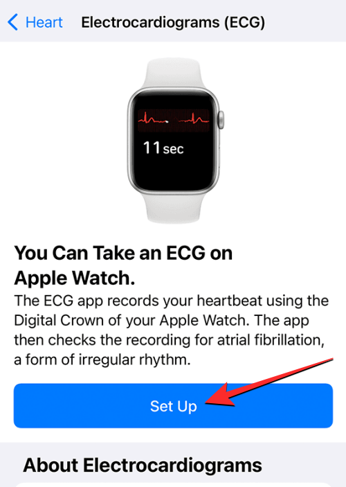 如何在 Apple Watch 上记录心电图:分步操作指南