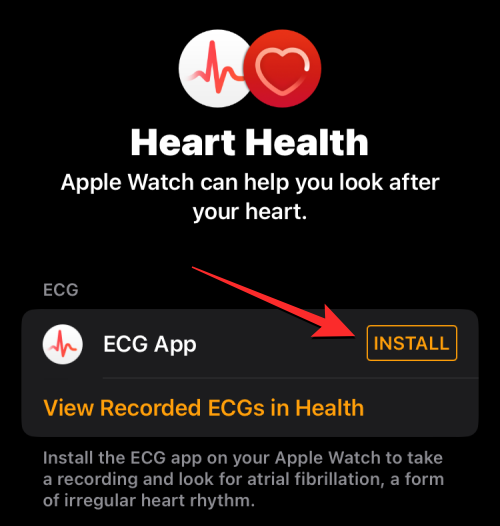 如何在 Apple Watch 上记录心电图:分步操作指南