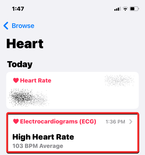如何在 Apple Watch 上记录心电图:分步操作指南