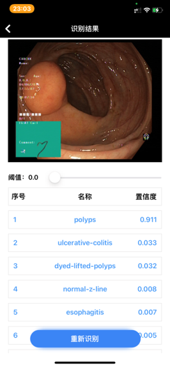 基于SMA线圈驱动的仿尺蠖肠胃诊察机器人