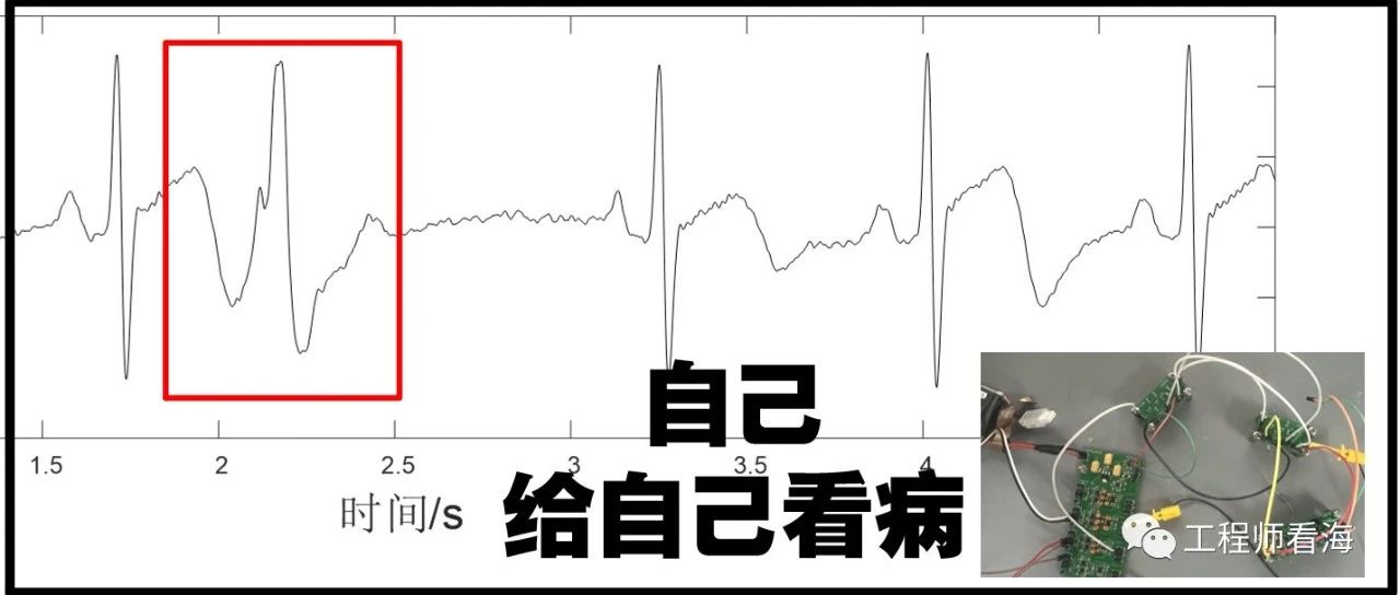 工程师病了？自己动手做心电图检测电路，顺便测一下心跳！