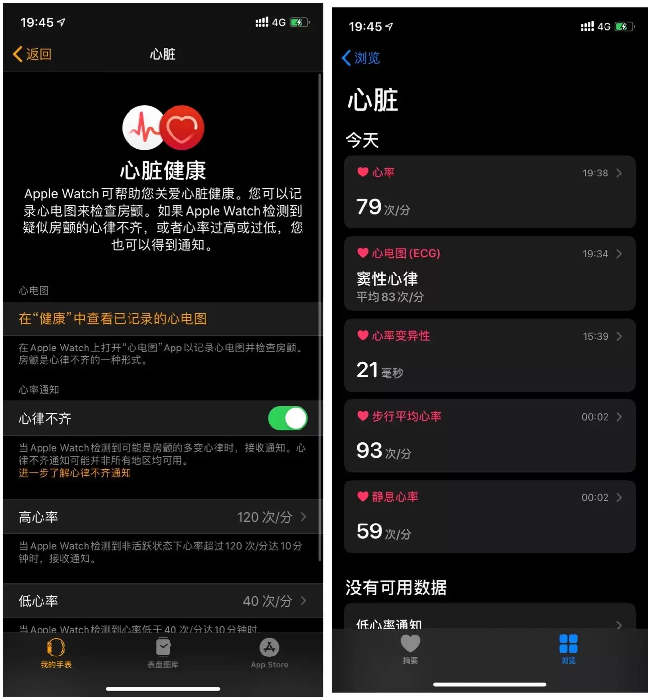 国行 Apple Watch 如何开通 ECG 功能? 国行 Apple Watch 如何开通 ECG 功能?