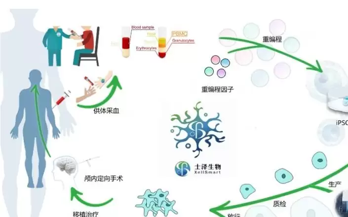 国产帕金森病创新药研发迎来里程碑,在中美两国取得进展