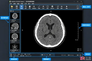 radiant dicom viewer 新手使用教程