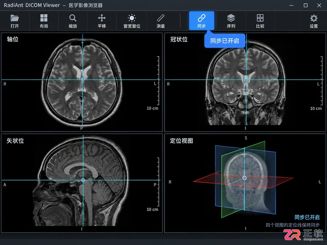 radiant dicom viewer 新手使用教程