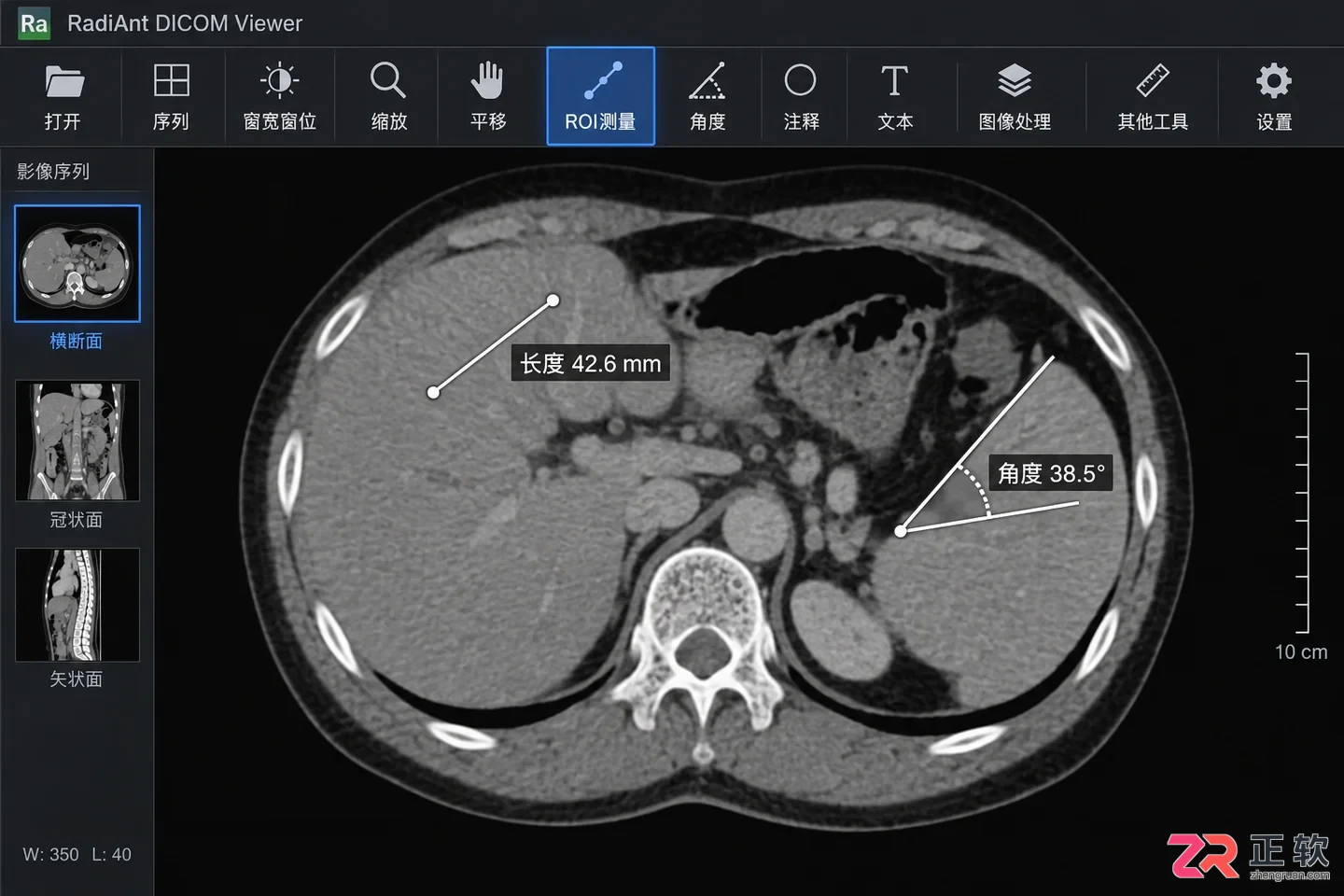 radiant dicom viewer 新手使用教程